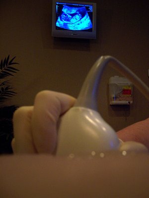 Danske forskere bag gennembrud i fosterdiagnostik