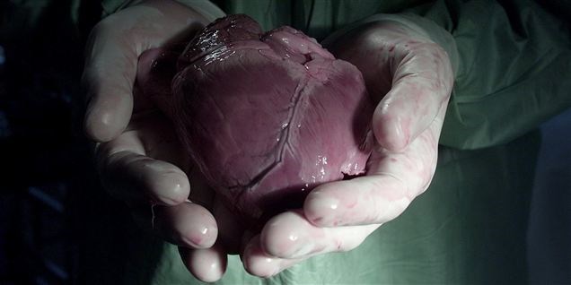 Antallet af organdonationer er rekordlavt